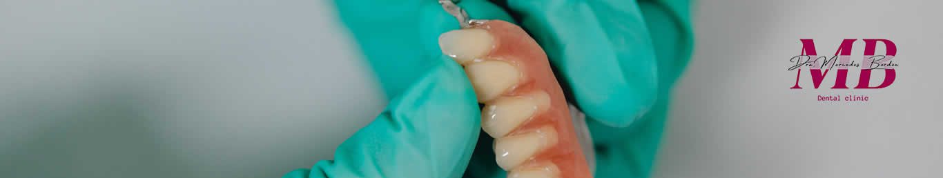 Prótesis Dentales
