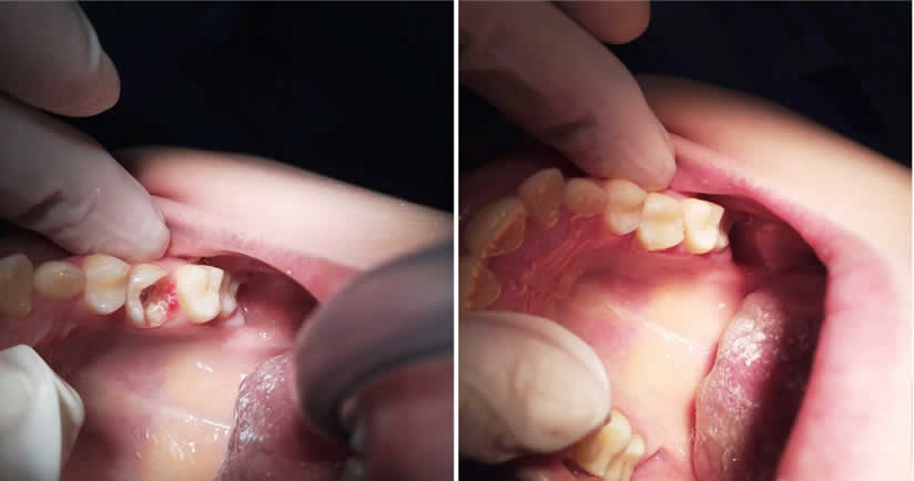 Odontología restauradora y estética
